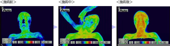 �o�b�N���f�R���e�g���[�g�����g�ɂ��畆�\�ʉ��x�̕ω�